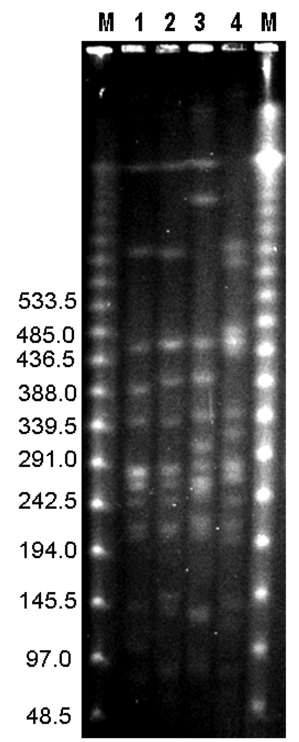 Pulsed-field gel electrophoresis of DNA from Burkholderia pseudomallei isolates digested with SpeI from patients with melioidosis in Taiwan. Lane M, bacteriophage λ DNA ladder (48.5 kb–970 kb). Lane 1, isolate from Kaohsiung County, 2005 (type A); lane 2, isolate from Tainan County, 2005 (type B); lane 3, isolate from northern Taiwan (type C); lane 4, isolate from northern Taiwan (type D). Values on the left are in kilobases.
