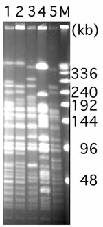 Thumbnail of Pulsed-field gel electrophoresis of ApaI restricted analysis of Acinetobacter baumannii isolates. Lane 1, A. baumannii AMA-1 from France (4); lanes 2 and 3, A. baumannii IST-1 and A. baumannii IST-2 from Turkey (4); lane 4, A. baumannii isolate from Belgium (4); and lane 5, A. baumannii MOS-1 from Russia (current study). Numbers on the right side of the figure represent the sizes in kb. M, lambda ladder.