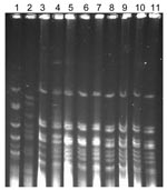 Thumbnail of Pulsed-field gel electrophoresis (PFGE) pattern of the Neisseria meningitidis isolates from the outbreak. The chromosomal DNA digested with SpeI enzyme was separated by clamped homogeneous electric fields PFGE (BioRad, Hercules, CA, USA). 1, RRL-1; 2, RRL-2; 3, SFDJ 723; 4, Ap-II 420; 5, SFDJ E-95; 6, IR-I 442, 7, IR-II 440; 8, SFDJ E-100; 9, SFDJ 184; 10, SFDJ E-79; 11, NICD 18.