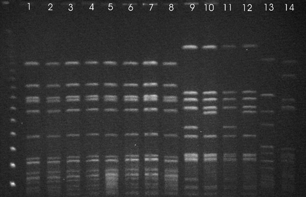 Pulsed-field gel electrophoresis patterns of SmaI-digested DNA of bovine and human strains of Staphyloccocus aureus isolated from cows with subclinical mastitis, Hungary, January 2002–December 2004.
