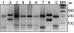 Thumbnail of Comparison between endonuclease BsuRI digestion patterns of internal transcribed spacer 1–PCR products from clinical samples and reference Leishmania strains. Clinical samples, lanes 1–6: lane 1, Boulmane; lane 2, Ouarzazate; lanes 3–6, Sidi Kacem. Reference strains, lanes 7–9: lane 7, L. tropica (MHOM/SU/1974/SAF-K27); lane 8, L. major (MHOM/TM/1973/5ASKH); lane 9, L. infantum (MHOM/TN/1980/IPT1). MW, DNA molecular weight marker in base pairs (bp).