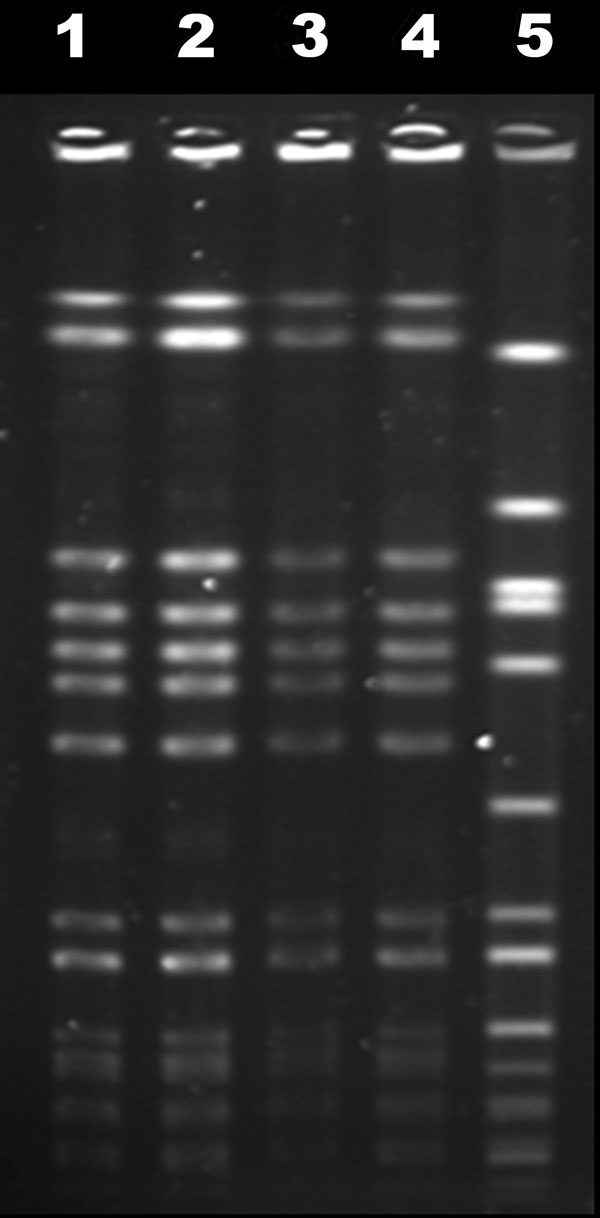 Pulsed-field gel electrophoresis profiles of November and February blood isolates (lanes 1 and 2), April lumbar isolate (lane 3), reference USA300-0114 isolate (lane 4), and internal control g195a (lane 5).