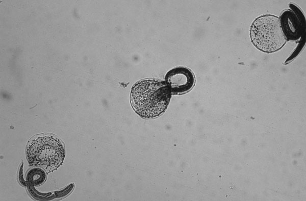 Hatched, stained, nonviable Baylisascaris procyonis larvae (magnification ×10).