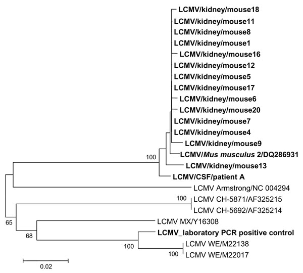 Phylogenetic tree based on 400-nt sequences amplified by PCR system 1 in the nucleoprotein gene. Lymphocytic choriomeningitis virus (LCMV) sequences characterized in this study were compared with selected homologous LCMV sequences available in the GenBank database. Sequence information corresponds to virus/nature of specimen/host/GenBank accession no. (optional), except for sequences retrieved from GenBank (virus strain/GenBank accession no.). Sequences determined in this study are in bold type.