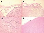 Thumbnail of Histologic staining (hematoxylin and eosin) of Florida cotton rat tissues 9 days after intracranial inoculation with 3 log10 PFU of enzootic Venezuelan equine encephalitis virus (subtype IE). A) Inflammation of the meninges (arrows). B) Inflammation of the meninges and dilated blood vessels (arrows). C) Perivascular cuffing of blood vessels (arrow). D) Brain from a noninfected rat. (Magnification ×40.)