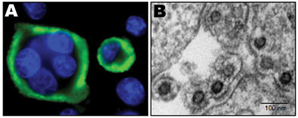 Immunofluorescence and electron microscopy results. A) Typical multinucleated giant cells with a clear seroreactivity of AG16 antigens, determined by using an immunofluorescence assay with positive anti–foamy virus serum, on BHK-21–infected cells cocultivated with stimulated peripheral blood mononuclear cells. B) Electron microscopy of ultrathin sections from cells infected by AG16 foamy virus.