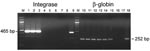 Thumbnail of Semiquantitative PCR for integrase and β-globin genes using AG15 peripheral blood buffy-coat DNA. Lanes 1–7 and 10–16, serial dilutions of the DNA from 500 ng to 0.5 pg; lanes 8 and 17, negative controls; lanes 9 and 18, positive controls; M, 100-bp ladder.