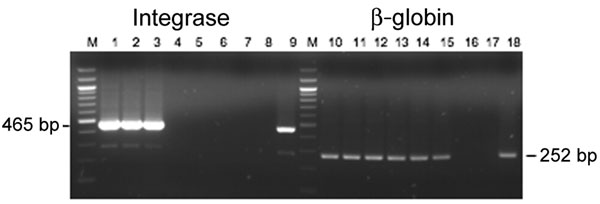 Semiquantitative PCR for integrase and β-globin genes using AG15 peripheral blood buffy-coat DNA. Lanes 1–7 and 10–16, serial dilutions of the DNA from 500 ng to 0.5 pg; lanes 8 and 17, negative controls; lanes 9 and 18, positive controls; M, 100-bp ladder.