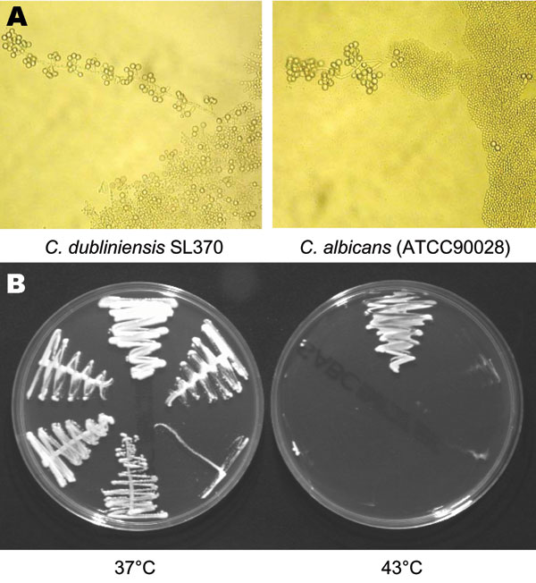 Phenotypic characteristics of environmental Candida dubliniensis isolates and reference strain of C. albicans. A) Morphology of pseudohyphal terminal chlamydospores of C. albicans (ATCC90028) and C. dubliniensis SL370 grown at 37°C on Corn Meal Tween 80 agar. Magnification × 50. B) Growth of representative Great Saltee (SL) isolates on Sabouraud agar after 48 h of incubation at 37°C and 43°C. The growth of the following isolates is shown: C. albicans (ATCC90028), C. dubliniensis (NCPF3949), and C. dubliniensis SL370, SL397, SL407, and SL410 (clockwise from the top in each panel).