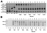 Thumbnail of Evaluation of sensitivity of multiple site–specific heteroduplex tracking assay (MSS-HTA). A) MSS-HTA tested against known concentrations of Plasmodium falciparum DNA. Visible bands representing mutant DNA remain until the 1% population (lanes N and O). B) the same dilution series assayed with allele-restricted PCR (ARPCR), where visible mutant bands (366 bp) are not seen past the 20% mutant population (lanes I and J). The lanes marked with W and M represent wild-type and mutant res