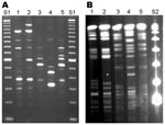 Thumbnail of Repetitive element (Rep)–PCR (A) and pulsed-field gel electrophoresis (PFGE) (B) patterns of Mycobacterium cosmeticum isolates from 2 patients in Ohio and 1 patient in Venezuela. Rep-PCR was performed by using BOXA1R primer (3), and PFGE was performed with restriction enzyme AseI. Lanes 1, 2, Ohio isolates OH1 and OH2; lanes 3, 4, control strains ATCC BAA-878T and ATCC BAA-879; lane 5, Venezuelan isolate VZ1. DNA size standards are 100-bp (S1) and 48.5-kb marker (S2).