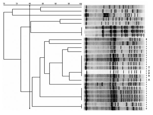 Pulsed-field gel electrophoresis (PFGE) banding patterns of chromosomal DNA of 26 isolates of vancomycin-resistant enterococci. There is a clear predominant type, classified as type A (≥80% similarity), composed of 18 isolates of Enterococcus faecium. There are at least 3 subtypes that display a 100% similarity.