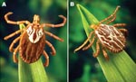 Thumbnail of Adult Amblyomma maculatum (the Gulf Coast tick). A) Female; B) Male. Photographs courtesy of James Gathany, Centers for Disease Control and Prevention