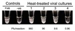 Thumbnail of Visual inspection of the positivity of LAMPreactions. Heated, treated viral culture was serially diluted and tested by the LAMP assay. Reactions were visually inspected after the incubation. Positive reactions would produce large amounts of white magnesium pyrophosphate precipitate, thereby increasing the turbidity of these reactions (+ve control and samples 1 to 3). By contrast, negative reactions (-ve control and sample 4) remained transparent after the incubation. The amount of p