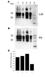 Thumbnail of Antibody-binding patterns of the prion protein (PrPSc) associated with cases of ARR/ARR scrapie in France and Germany. A) and B) Western blots showing the differences in monoclonal antibody (MAb) P4 binding compared with the internal standard MAb L42 of PrPSc derived from S115/04 (ARR/ARR Germany), S83 (ARR/ARR France), ovine ARQ/ARQ bovine spongiform encephalopathy (BSE), and S95 (classic scrapie) cases. Banding intensities were quantified by photoimaging, and binding ratios were calculated. Note the significantly weaker P4 binding to the ovine BSE sample. Lane 1, S115/04; lane 2, S83; lane 3, S95; lane 4, ovine BSE; lane 5, atypical S15. C) Relative MAb binding ratios for lane nos. 1–4 in the Western blots shown in A) and B).