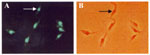 Thumbnail of In situ hybridization of Rhodnius pictipes-derived flagellates with an archetypic Berenice Trypanosoma cruzi-specific probe. The byotinylated 198-bp sequence amplified with Tcz1/2 nuclear DNA probe (37) was revealed with fluorescein-conjugated streptavidin. This genotypic marker, representing 12.5% of total parasitic nuclear DNA, also confirms this sylvatic isolate as T. cruzi.
