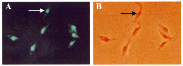 In situ hybridization of Rhodnius pictipes-derived flagellates with an archetypic Berenice Trypanosoma cruzi-specific probe. The byotinylated 198-bp sequence amplified with Tcz1/2 nuclear DNA probe (37) was revealed with fluorescein-conjugated streptavidin. This genotypic marker, representing 12.5% of total parasitic nuclear DNA, also confirms this sylvatic isolate as T. cruzi.