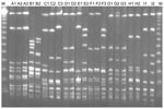Thumbnail of Pulsed-field gel electrophoresis profiles of all isolates from patients with recurrent group G streptococcal bacteremia. Isolates B1 and B2, Streptococcus canis; other isolates, S. dysgalactiae subsp. equisimilis (see designation of the isolates in Table 2). Lane M, molecular mass marker.
