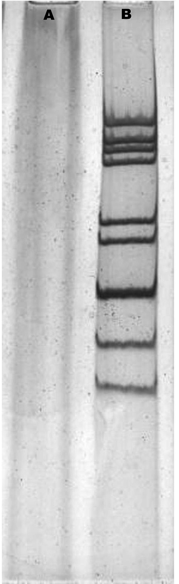 Polyacrylamide gel electrophoresis of rotavirus RNA. The viral RNAs were analyzed by electrophoresis in a polyacrylamide gel and visualized by silver staining. A, negative control; B, Wuhan G9 strain (CC589).