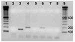 Thumbnail of PCR amplification of internal transcribed spacer 16S–23S on vegative and normal-appearing valves of cows 04–927 and 05–1406. 1, Molecular weight marker; 2, negative control; 3, Bartonella quintana; 4, B. bovis; 5 and 6, normal appearing and vegetative valves (Cow 04–927); 7 and 8, normal appearing and vegetative valves (Cow 05–1406); 9, molecular weight marker.