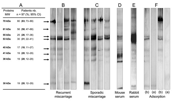 Western blot analyses. A) Molecular weight and frequency of IgG reactivity of Waddlia proteins, as determined by Western blots. B) and C) Four representative Western blot patterns of Waddlia IgG positive sera from recurrent and sporadic miscarriage groups. D) and E) Representative Western blot pattern of positive control (Waddlia hyper-immune mouse and rabbit serum, respectively). F) Western blot performed with Waddlia IgG positive sera, taken from patients who had miscarried before (b) and after (a) adsorption with Waddlia antigen. MW, molecular weight; nb, number.