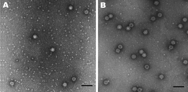 Electron micrographs of A) Syd53 and B) Syd3 viruslike particles of sapovirus. Scale bars = 100 nm.