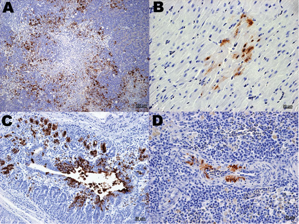 Immunohistochemical (IHC) staining for influenza virus nucleoprotein in tissues of naïve juvenile Canada geese after challenge with influenza virus (H5N1). A) Pancreas. Large areas of necrosis are surrounded by pancreatic acinar cells with strong positive intranuclear and intracytoplasmic immunolabeling. B) Heart. Positive intranuclear and intracytoplasmic immunolabeling of myocytes. C) Proventriculus. Strong positive immunolabeling of compound tubular gland epithelium. D) Splenic arteriole. Positive IHC staining of vascular smooth muscle cells.