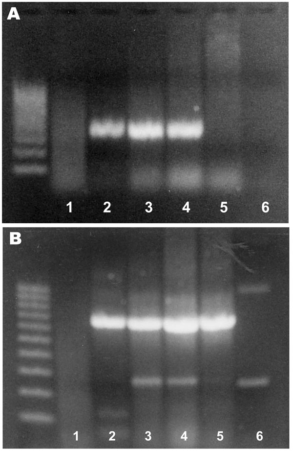 Agarose gel electrophoresis of PCR products from Rhinosporidium seeberi–specific primers (A) and β-actin primers (B). The left lane contains a 100-bp ladder. Samples 1–4, from horses with histologic diagnoses of rhinosporidiosis; sample 5, from the skin of a noninfected horse; sample 6, negative control (water).