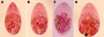 Thumbnail of Adult trematodes isolated from Vietnamese persons. A) Haplorchis pumilio. B) H. taichui. C) H. yokogawai. D) Stellantchasmus falcatus. (Semichon acetocarmine stained, magnification ×120.)