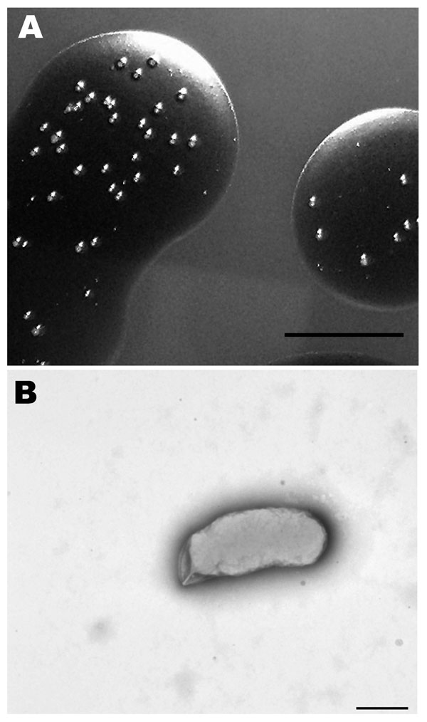 Morphologic analysis of a Bartonella sp. isolated from sheep blood. A) Colonies growing in sheep blood surface biofilm seen in reflected light after 25 days. Scale bar = 10 mm. B) Transmission electron micrograph of a representative cell that was dispersed from a 25-day-old colony and negatively stained with 0.5% potassium phosphotungstic acid. Scale bar = 500 nm