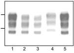 Thumbnail of Western blot analyses of protease-resistant prion protein from proteinase K–treated brain homogenates from cattle transmissible spongiform encephalopathies (TSEs). Typical bovine spongiform encephalopathy (BSE) (lanes 1, 5), L-type BSE (lane 2), transmissible mink encephalopathy (TME) in cattle (lane 3), H-type BSE (lane 4). Bars to the left of the panel indicate the 29.0- and 20.1-kDa marker positions.