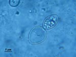 Thumbnail of Direct examination of sputum fluid showing Histoplasma capsulatum var. duboisii.