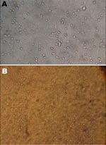 Thumbnail of A) Cytopathic effect of lyophilized Newcastle disease virus (NDV) vaccine strains on Vero cells. B) Hemagglutination test. Presence of tear-shaped erythrocytes confirms the specificity of the cytopathic effect of NDV on Vero cells.