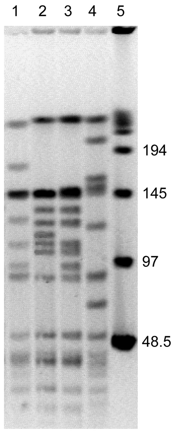 SmaI macrorestriction patterns of Bartonella henselae isolates from 2 cats. Lane 1, cat 36, first isolate; lane 2, cat 36, second isolate obtained 12 months later; lane 3, cat 75, first isolate; lane 4, cat 75, second isolate obtained 12 months later; lane 5, bacteriophage λ molecular mass pulsed-field gel electrophoresis marker. Values on the right are in kilobases.