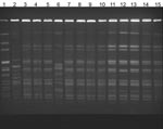 Thumbnail of Pulsed-field gel electrophoresis of isolates from patients with Alcaligenes xylosoxidans bloodstream infection. Lane 1, laboratory standard; lanes 2 and 6, community strains of A. xylosoxidans; lanes 3–5 and 7–13, outbreak strains; lane 14, central venous catheter (CVC) port biofilm outbreak strain; lane 15, CVC port outbreak stain.
