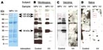 Thumbnail of Development of a monkeypox (MPV)–specific diagnostic assay using Western blot analysis. Adsorption of cross-reactive orthopoxvirus antibodies with vaccinia antigen before Western blot analysis provided easier identification of monkeypox-specific bands. A) Two micrograms of sucrose gradient–purified monkeypox virus or vaccinia virus (VV) were separated by sodium dodecyl sulfate–polyacrylamide gel electrophoresis (4%–20% gels) and stained with GelCode Blue (Pierce, Rockford, IL, USA) to compare banding patterns and confirm equivalent protein loading. Proteins were electrophoretically transferred to polyvinylidene difluoride membranes and probed with plasma from B) a monkeypox-immune person, C) a vaccinia-immune person, or D) an orthopoxvirus-naive person after adsorption of plasma with control antigen (uninfected H2O2-treated BSC40 cell lysate) or vaccinia antigen (H2O2-inactived vaccinia-infected BSC40 cell lysate). Immunoreactive bands were detected with peroxidase-conjugated antihuman immunoglobulin G plus chemiluminescent substrate and exposed to x-ray film. Arrows indicate location of diagnostic bands with apparent molecular masses of 148, 124, and 39 kDa. Rectangles indicate locations of diagnostic bands.