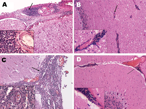 Main histopathologic finding of neurobrucellosis in Stenella coeruleoalba. A) Mononuclear infiltrates in the meninges (arrow) surrounding the spinal cord; B) mononuclear infiltrate around vessels (arrow) of the cerebellum; C) mononuclear infiltrate (arrow) in the meninges around the brain; D) hyperemic vessels and mononuclear cell infiltrate in the meninges around the cerebellum (arrow). The insets correspond to amplified sections of each figure demonstrating the mononuclear cell infiltrate.