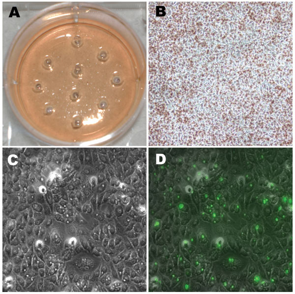 Photographs of light and fluorescent microscopy showing the shotgun cell culture harvest method for isolating clonal populations of clinically persistant strains. A) 1 well in a 6-well plate after harvesting 10 random areas using sterile pipettes; no plaques could be visualized in any well unlike the situation for the reference strains in Figure 2. B) The same well before harvesting infected areas (magnification ×100). C) Light microscopy view of an area with infected cells containing small inclusion bodies after agarose overlays had been removed (magnification ×400). D) Fluorescent microscopy view of the same field as in C (magnification ×400); infected cells were stained with Chlamydia trachomatis–specific lipopolysaccharide antibodies. Arrows denote small fluorescing inclusion bodies within the cell cytoplasm.