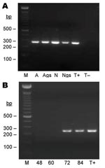 Thumbnail of Seminested PCR detection of Bartonella spp. DNA after partial refeeding of infected ticks. A) Bartonella spp. DNA detection in Ixodes ricinus ticks fed on B. henselae–infected blood at previous development stages and refed for 84 h on uninfected blood. Lane M, 100-bp DNA molecular mass; lane A, carcass of female adult; lane Ags, salivary glands of female adult, lane N, carcass of nymph; lane Ngs, salivary glands of nymph; lane T+, B. bacilliformis DNA; lane T–, nymph fed on uninfected ovine blood. B) Bartonella spp. DNA detection in blood isolated from feeders. Lane M, 100-bp DNA molecular mass marker; lane 48, ovine blood after 48 h of tick attachment on skin; lane 60, ovine blood after 60 h of tick attachment on skin; lane 72, ovine blood after 72 h of tick attachment on skin; lane 84, ovine blood after 84 h of tick attachment on skin; lane T+, B. bacilliformis DNA.