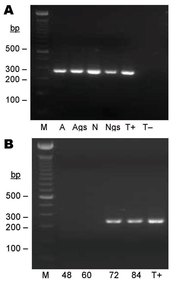 Seminested PCR detection of Bartonella spp. DNA after partial refeeding of infected ticks. A) Bartonella spp. DNA detection in Ixodes ricinus ticks fed on B. henselae–infected blood at previous development stages and refed for 84 h on uninfected blood. Lane M, 100-bp DNA molecular mass; lane A, carcass of female adult; lane Ags, salivary glands of female adult, lane N, carcass of nymph; lane Ngs, salivary glands of nymph; lane T+, B. bacilliformis DNA; lane T–, nymph fed on uninfected ovine blood. B) Bartonella spp. DNA detection in blood isolated from feeders. Lane M, 100-bp DNA molecular mass marker; lane 48, ovine blood after 48 h of tick attachment on skin; lane 60, ovine blood after 60 h of tick attachment on skin; lane 72, ovine blood after 72 h of tick attachment on skin; lane 84, ovine blood after 84 h of tick attachment on skin; lane T+, B. bacilliformis DNA.