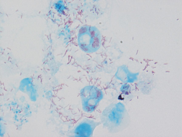 Rickettsia conorii conorii observed in Vero cells (red rods; magnification ×1,000).