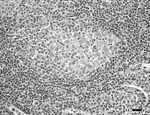 Thumbnail of Focal histiocytic lymphadenitis caused by Mycobacterium bovis in a coyote (Canis latrans). Note the small, poorly delineated, aggregates of primarily macrophages within the lymph node cortex. Scale bar = 25 μm.