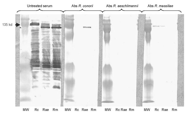 Western blot assay (WB) and cross-adsorption studies in serum of a patient with rickettsiosis in Algeria. Immunofluorescent assay showed raised levels of immunoglobulin (Ig) G/M at the same titer (2,048/32) against Rickettsia conorii, R. aeschlimannii, and R. massiliae. Lanes Rc, Rae, and Rm: WB assay using R. conorii, R. aeschlimannii, and R. massiliae antigens, respectively. MW, molecular weights are indicated on the left. Untreated serum, late serum samples tested by WB. When adsorption is performed with R. aeschlimannii antigens, homologous and heterologous antibodies disappear, but when it is performed with R. conorii antigens and R. massiliae, homologous antibodies disappear but heterologous antibodies persist. This result indicates that antibodies are specifically directed against R. aeschlimannii. Abs, absorbed.