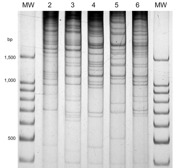Direct genome restriction enzyme analysis with NaeI of clinical isolates of Vibrio parahaemolyticus representative of the 5 patterns observed during the outbreaks in Puerto Montt, Chile, January and February, 2007. Lanes MW, 100-bp size ladder; lane 2, PMC38.7; lane 3, PMC60.7; lane 4, PMC53.7; lane 5, PMC75.7; lane 6, VpKX. (O3:K6 pandemic isolate).