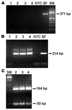 Thumbnail of PCR product from the 17-kDa protein antigen gene obtained from DNA extracted from necropsied tissues of the patient. Primary PCR (A), nested PCR (B), and BfaI restriction enzyme pattern of the 17-kDa protein gene amplicon (C). Lane 1, reagent control; 2, skin; 3, liver; 4, lung; NTC, nontemplate control; SF, Rickettsia conorii DNA control; SM, size markers.