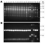 Thumbnail of DNA fingerprint patterns of 12 Cryptococcus neoformans strains from China and the molecular type reference strains. A) M13-based PCR pattern. B) URA5 restriction fragment length polymorphism. Lanes: 1, VNI; 2–12, 11 Chinese strains; 13, H99; 14, Chinese strain B-4587; 15, VNBt63; 16, VNI; 17, VNIII; 18, VNII; 19, VNI; 20, marker.