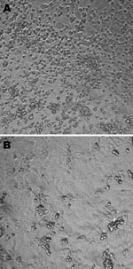 Thumbnail of A) Cytopathic effects (round cells) observed 6 days after infection of rhesus monkey kidney (LLC-MK2) cells (second passage) with the Can112051-06 Saffold virus–like cardiovirus strain. B) Uninfected LLC-MK2 cells. Maginification ×10.