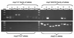 Thumbnail of Molecular typing of malarial parasites from 6 US travelers with falciparum malaria returning from East Africa in 2005. Plasmodium falciparum merozoite surface protein 1 (Pfmsp1) (upper gel) and Pfmsp2 (lower gel) allelic variation among isolates was determined by nested PCR and agarose gel electrophoresis. DNA markers (MW) are in lanes 1 and 13 in each gel. Two family-specific primer sets were used for each of the 2 genes. No parasites of the Ro33 allelic family of msp1 were found (data not shown). Pretreatment (day 0) isolates are shown for all patients. Posttreatment (day 1) parasite isolates are also shown for patients 2–6.