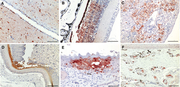 Figure 2&nbsp;-&nbsp;Immunohistochemical analysis for nucleoprotein of avian influenza virus. Tissue sections were stained by using the avidin-biotin-peroxidase complex method, 3-amino-9-ethylcarbazole (red), and hematoxylin (blue). A) Brain, cerebrum: numerous glial cells, neurons and ependymal cells stain positive for influenza virus antigen (scale bar = 200 μm). B) Eye, retina: cells of the pigmented epithelial layer, photoreceptor cells, and cells of the outer and inner nuclear layers are po