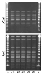 Thumbnail of XbaI and NotI pulsed-field gel electrophoresis patterns for clonal group H Escherichia coli isolated from women with urinary tract infections in Montréal, Québec, Canada, 2006. The 5 isolates shown were serogroup O6:H1. First and last lanes, bacteriophage λ.